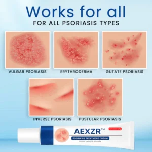 AEXZR™ Psoriasis Treatment Cream image AEXZR™ Psoriasis Treatment Cream