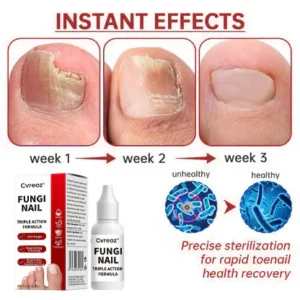 Cvreoz® Toenail Fungus Treatment image Cvreoz® Toenail Fungus Treatment