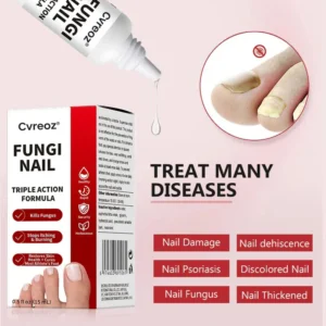Cvreoz® Toenail Fungus Treatment image Cvreoz® Toenail Fungus Treatment