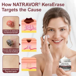 NATRAVOR® KeraErase Dual-Action Renewal Cream image NATRAVOR® KeraErase Dual-Action Renewal Cream