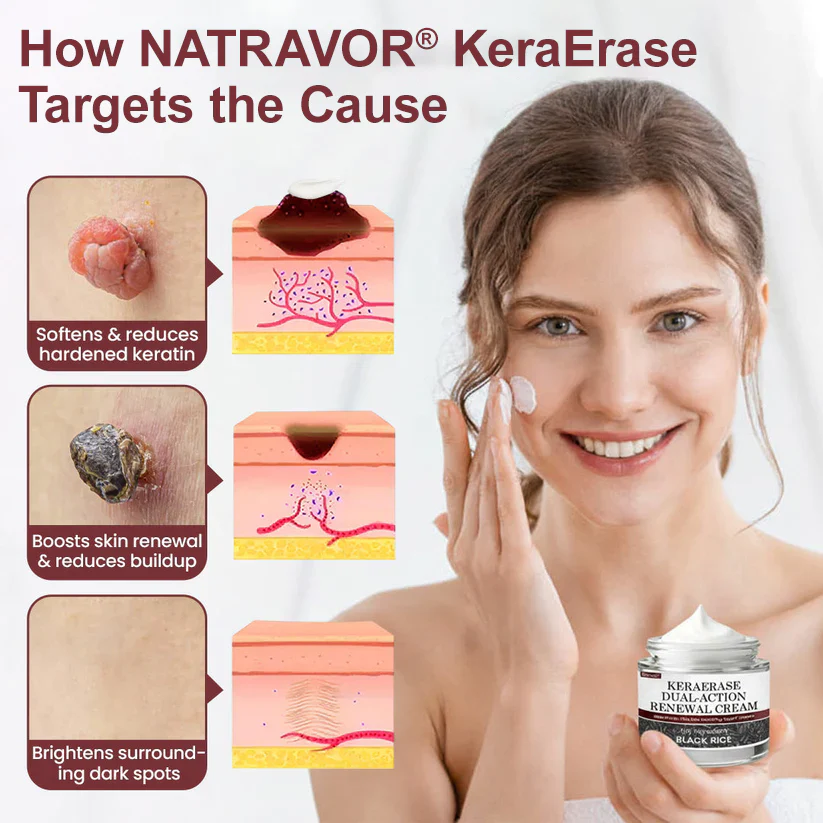 NATRAVOR® KeraErase Dual-Action Renewal Cream image NATRAVOR® KeraErase Dual-Action Renewal Cream