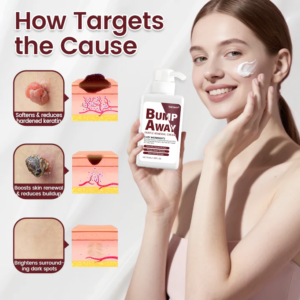 Natravor® BumpAway Gentle Renewal Cream