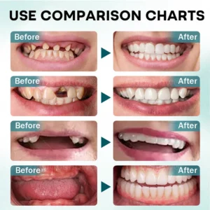 Dobshow® FirmHold Denture Adhesive image Dobshow® FirmHold Denture Adhesive