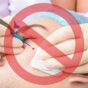 Elycura™ NatureErase Instant Mole & Spot Cream