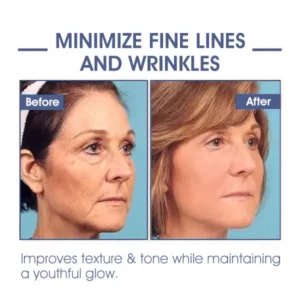 Ringminds®Advanced Firming & Wrinkle-Reducing Cream.