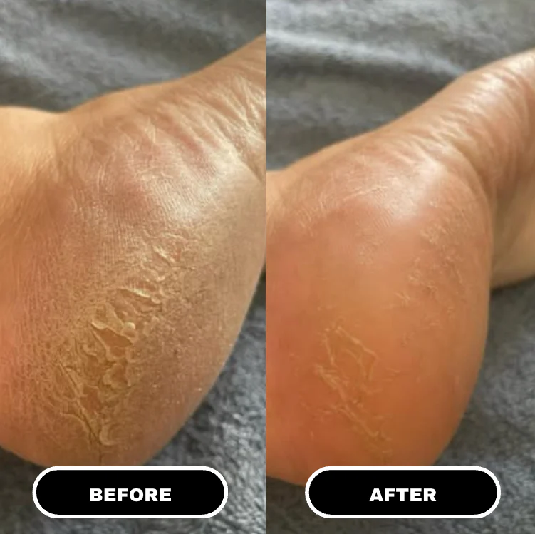 Heeluxe™ Comfort Repair Stick by Shoporia Store