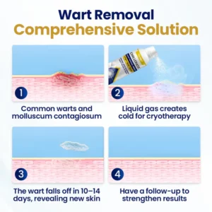 Timilk® ChillErase Bump Renewal Spray