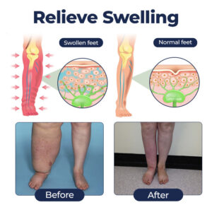 Timilk® SwellRelief Circulation Support Cream image Timilk® SwellRelief Circulation Support Cream