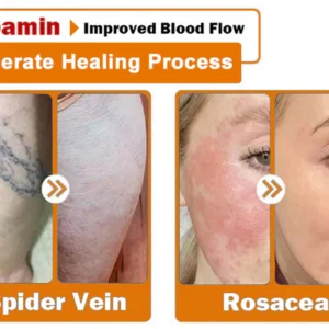 ODALIT™ Bee Venom Skin Treatment Cream