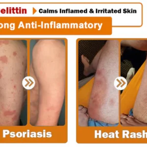 ODALIT™ Bee Venom Skin Treatment Cream