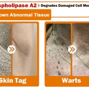 ODALIT™ Bee Venom Skin Treatment Cream