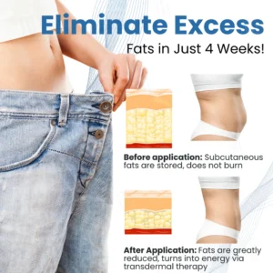 AEXZR® Clinical Body Sculpting System image AEXZR® Clinical Body Sculpting System