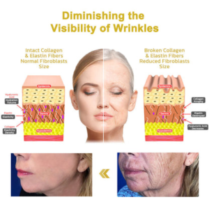 Ringminds®Advanced Firming & Wrinkle-Reducing Cream.