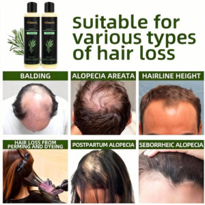 Slimoly® Rosemary Hydrolyzed Keratin Shampoo