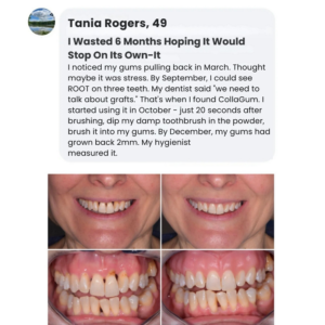 CollaGum™ Smile Strengthening Collagen Powder