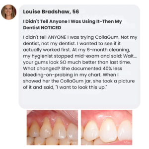 CollaGum™ Smile Strengthening Collagen Powder