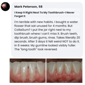 CollaGum™ Smile Strengthening Collagen Powder