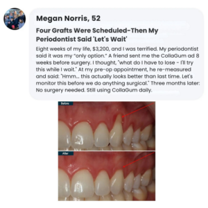 CollaGum™ Smile Strengthening Collagen Powder