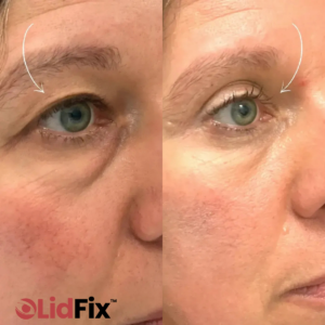 LidFix™ Double Eyelid Shaping Cream
