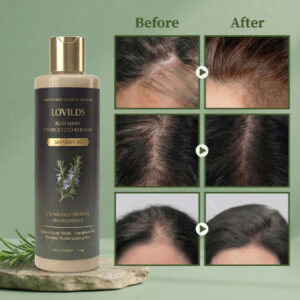 LOVILDS® Rosemary Hydrolyzed Keratin Shampoo