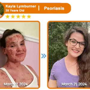 ODALIT™ Bee Venom Skin Treatment Cream