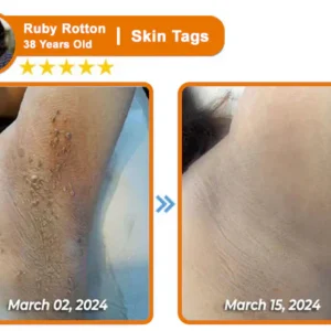 ODALIT™ Bee Venom Skin Treatment Cream