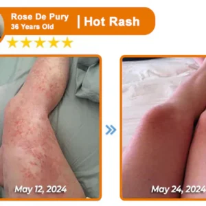 ODALIT™ Bee Venom Skin Treatment Cream