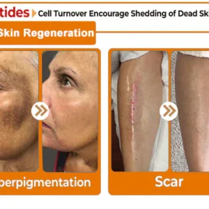 ODALIT™ Bee Venom Skin Treatment Cream