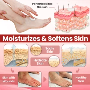 CVREOZ® DiaCare Diabetic Treatment Cream