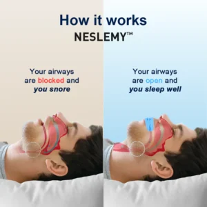 NESLEMY™Professional intelligent anti-snoring device