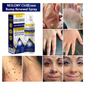 NESLEMY® ChillErase Bump Renewal Spray