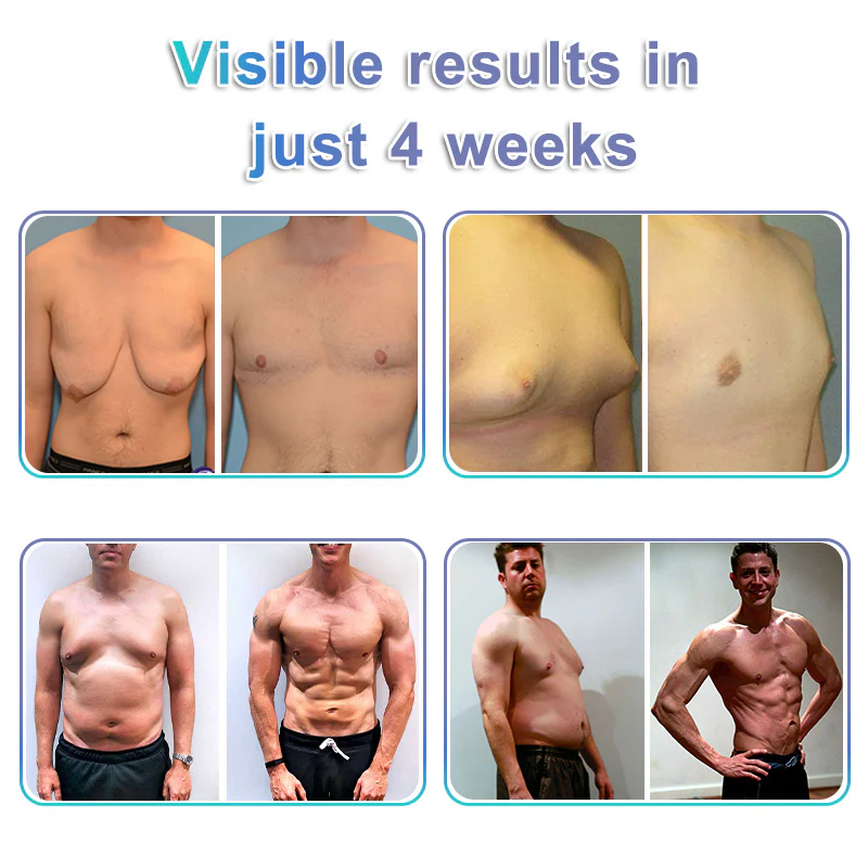 GFOUK® NanoMedix Gynecomastia Chest Fatburn & Firm Patch