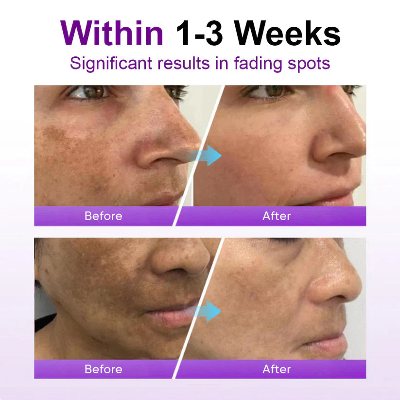 ODALIT™ Spoterase Probiotic Shield Serum