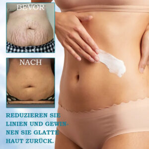 Ringminds®Advanced Firming & Wrinkle-Reducing Cream.