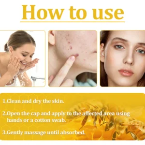 ODALIT™ Bee Venom Skin Treatment Cream