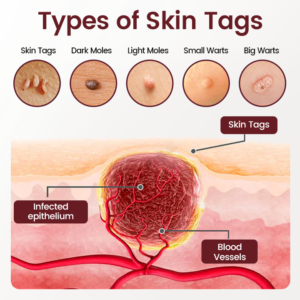 Natravor® BumpAway Gentle Renewal Cream