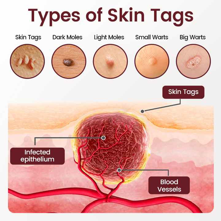 Timilk® BumpAway Gentle Renewal Cream image Timilk® BumpAway Gentle Renewal Cream