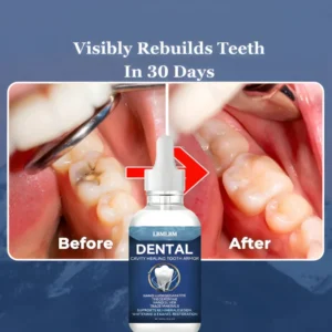 LBMLBM™ Teeth Armor Drops image LBMLBM™ Teeth Armor Drops