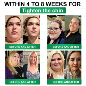 VitaRace® Superfood Nano Microneedle Metabolism Patch