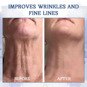 Ringminds®Advanced Firming & Wrinkle-Reducing Cream.