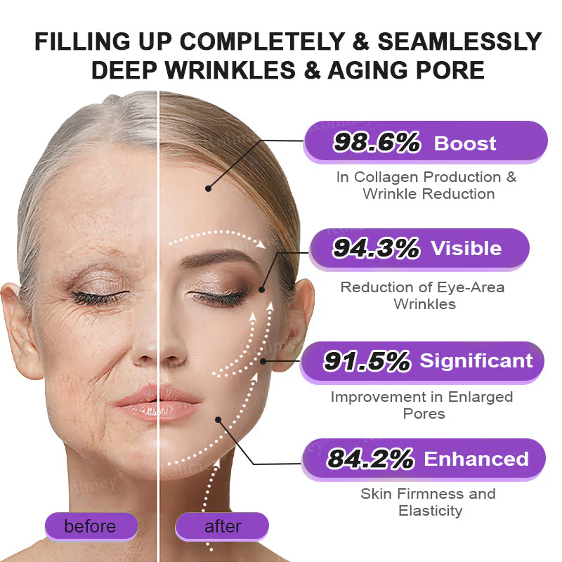 Rolimey® NAD+ Retinol Firming & Lifting Cream