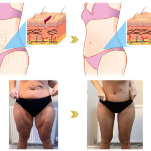 Ringminds®Advanced Firming & Wrinkle-Reducing Cream.