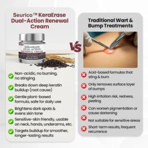 Seurico™KeraErase Dual-Action Renewal Cream