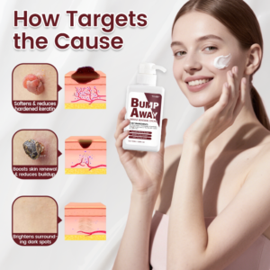 Timilk® BumpAway Gentle Renewal Cream image Timilk® BumpAway Gentle Renewal Cream