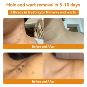 ODALIT™ Bee Venom Skin Treatment Cream