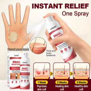 KUBOZN® Beef Tallow Spray for Itchy, Flaky Psoriasis Skin