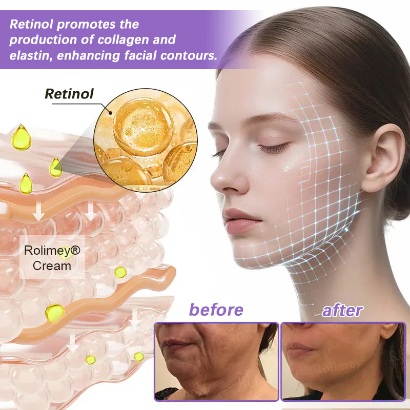 Rolimey® NAD+ Retinol Firming & Lifting Cream