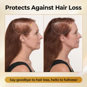 Timilk® CollagenGrow Peptides Hair Growth Spray image Timilk® CollagenGrow Peptides Hair Growth Spray