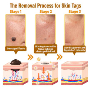 Flysmus® Bee Venom Comprehensive Cream image Flysmus® Bee Venom Comprehensive Cream