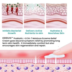 ODEIUN™ Probiotic + B 24-7 Moisture Eczema Relief Cream